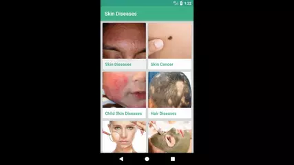 Skin Diseases and Treatments